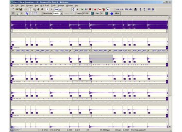 Zero-X BeatQuantizer