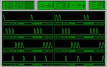Music Unfolding Collective 8 Audio Units